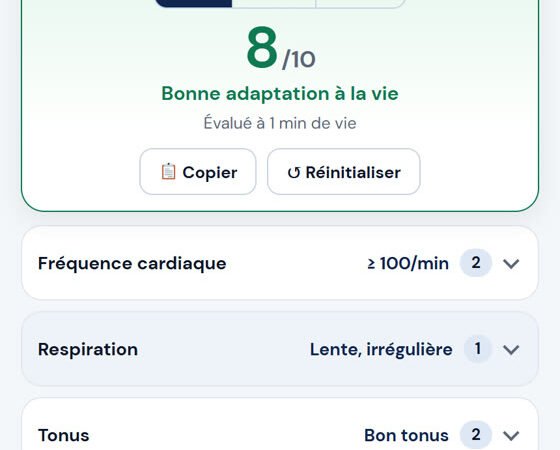 Score d’Apgar : évaluer le nouveau-né à 1, 5 et 10 minutes